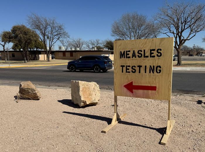 西テキサスにおける麻疹アウトブレイクの衝撃的な事態